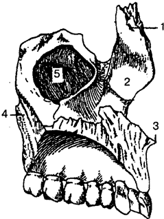 Левая верхняя челюсть (вид с медиальной стороны).